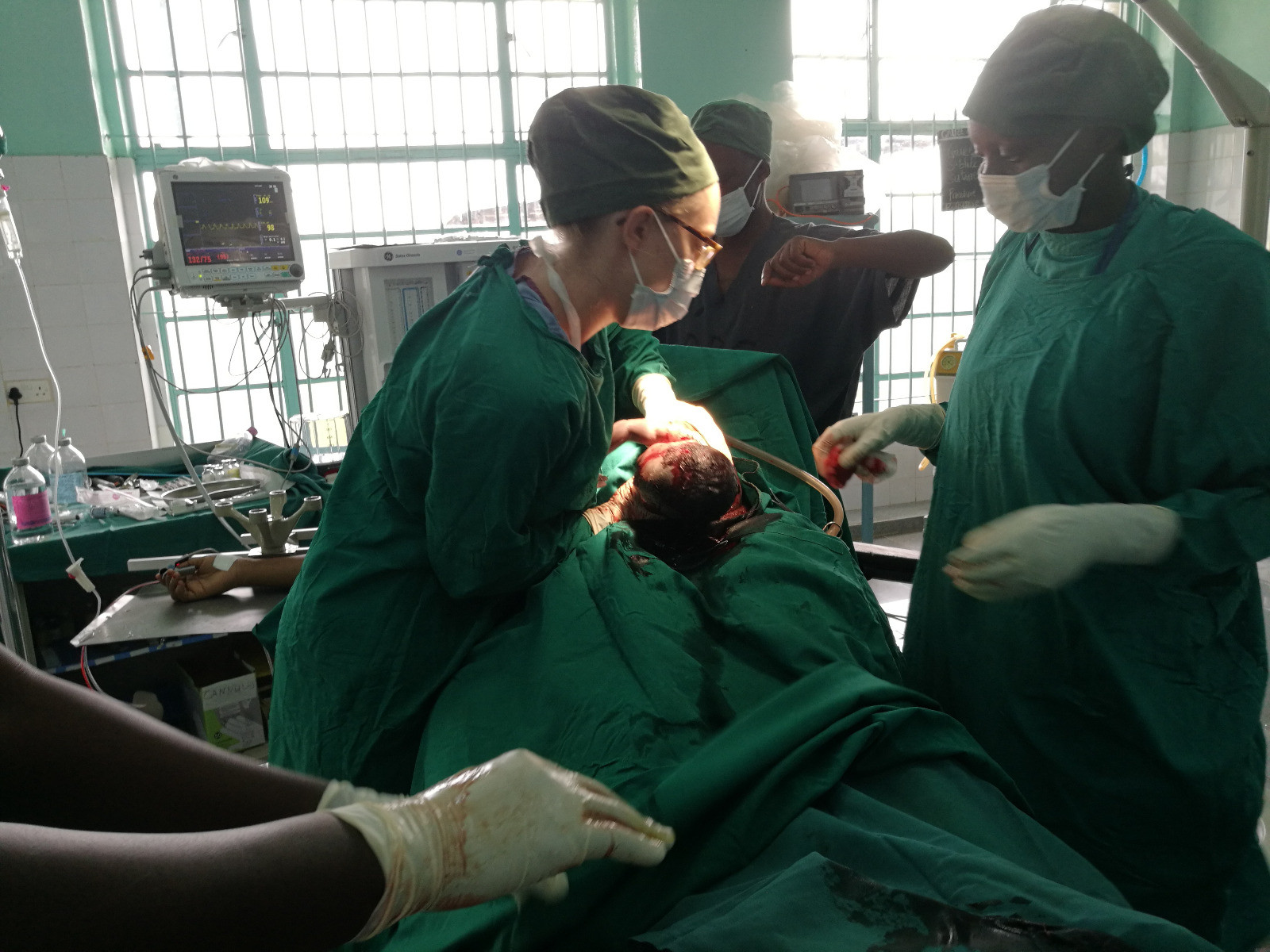 caesarian section